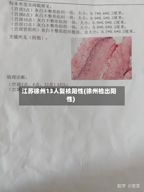 江苏徐州13人复核阳性(徐州检出阳性)